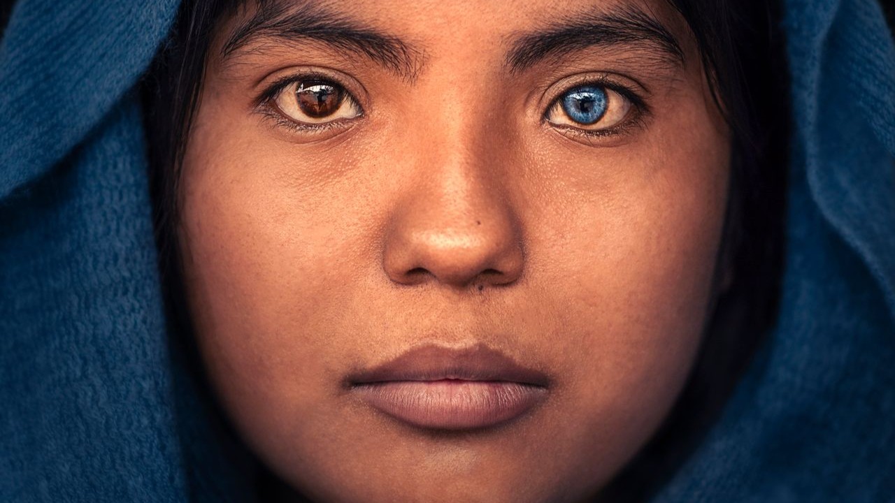 ¿Cómo se puede cambiar el color de los ojos? Mitos, realidades y riesgos médicos.